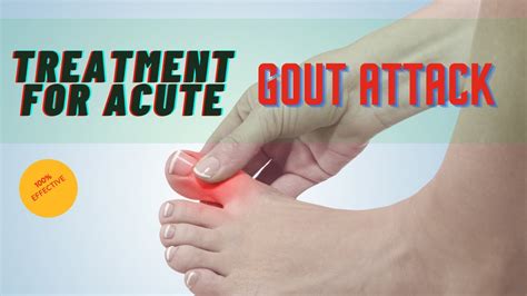 Gout Pain Treatment For Acute Gout Attack Natural Health Tips