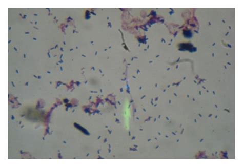 Gram Stain From The Positive Blood Culture Numerous Gram Positive Rods