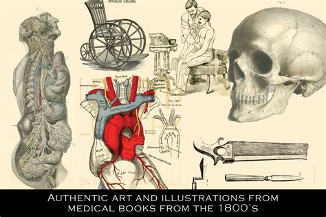 100 Vintage Medical Illustrations On Yellow Images Creative Store