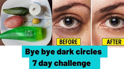 How To Remove Dark Circles Permanently 7 Days Challenge Home