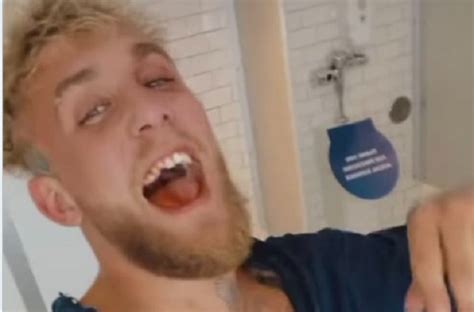 Jake Paul Ended Up With A Black Eye And Broken Tooth After Getting Into
