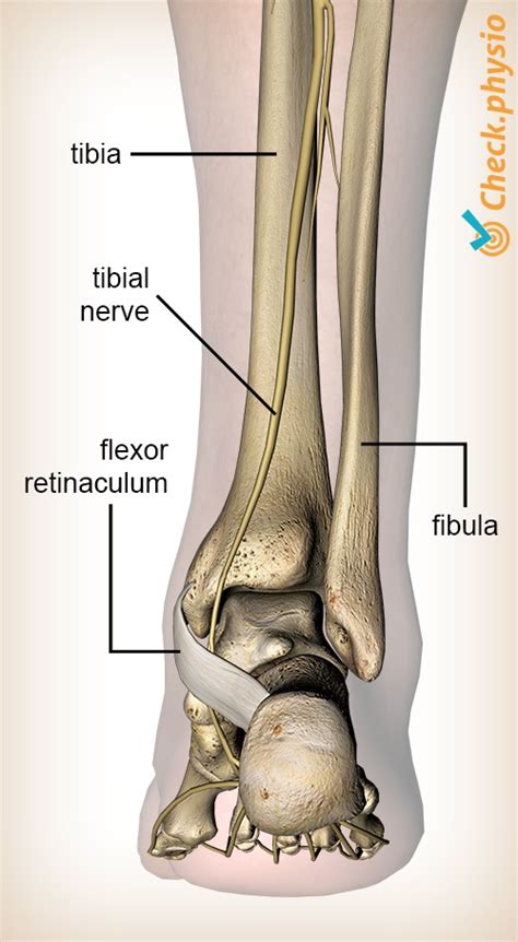 Tarsal Tunnel Syndrome Physio Check