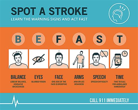What Are The Signs And Symptoms Of A Stroke Cns