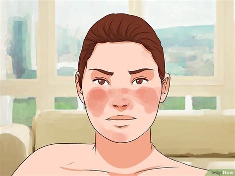 Maybe you would like to learn more about one of these? Lupus diagnostizieren - wikiHow
