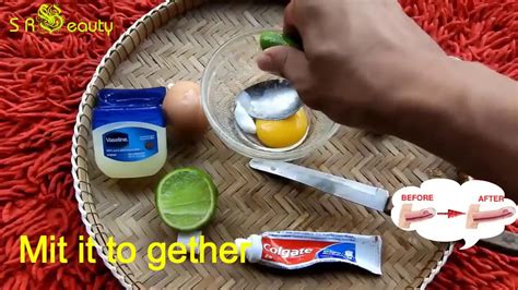 How To Make Penis Bigger Home Remedy Youtube