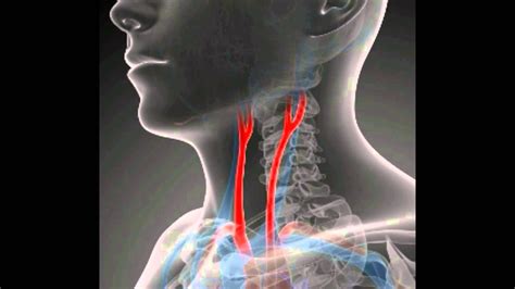 Blocked Arteries In Neck Vascular Structure Head And Neck Almas Khan
