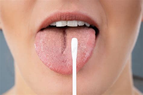 Taking Saliva Test From Woman S Mouth Stock Photo Image Of Saliva