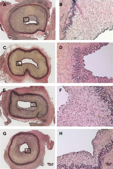 Carotid arteries from the four treatment groups. Arterial ...