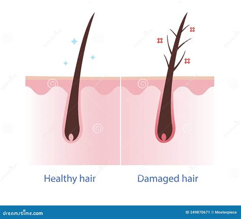 Layer Of Healthy And Damaged Hair Structure The Hair Shaft Consists Of