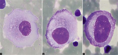 The Panorama Of Different Faces Of Mesothelial Cells Cytojournal