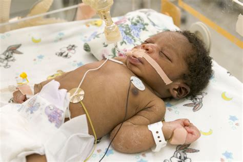 Baby In Neonatal Care