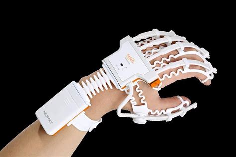 This Smart Glove Speeds Rehabilitation Of Stroke Patients Smart