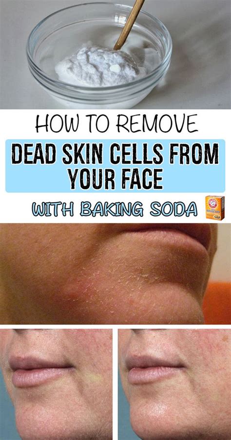 How To Remove Dead Skin Cells From Your Face With Baking Soda