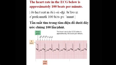 How To Calculate Heart Beats Per Minute From A Graph