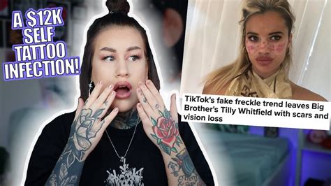 Face Tattoo Removal Tiktok Into A Large Microblog Diaporama