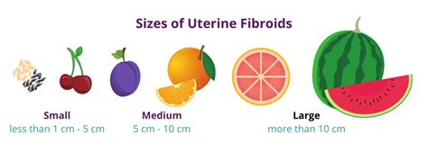Fibroid Tumor Sizes A Visual Guide Usa Fibroid Centers Mex Alex