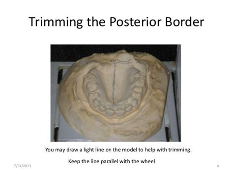 Study Models 101 Trimming