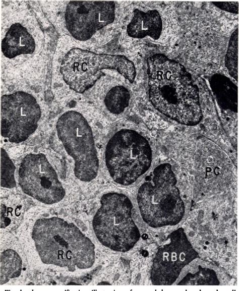 Figure 1 From Normal Human Lymph Node Cells An Electron Microscopic