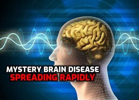 Deadly Brain Disease Spreading Rapidly Leaving Patients ‘seeing Death