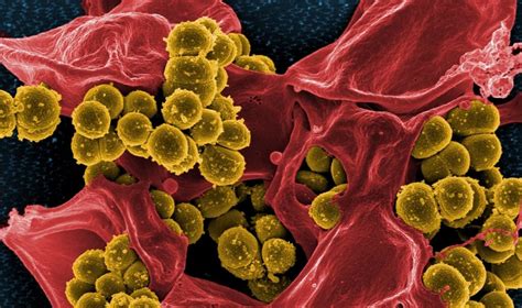 Drug Resistant Superbugs A Global Threat Intensified By The Fight