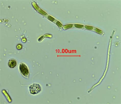 Filamentous Algae Microscope