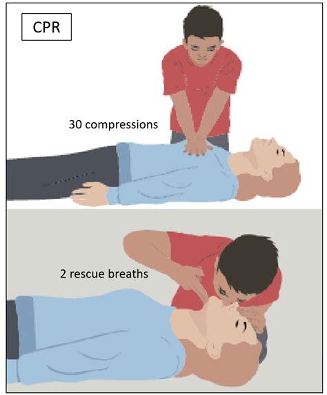 How To Perform Cpr The 6 Steps You Should Know