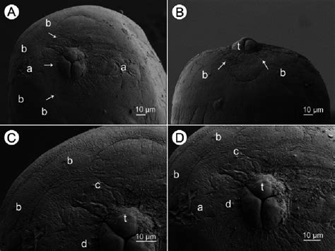 Philometra Lati Sp N Scanning Electron Micrographs Of Cephalic End