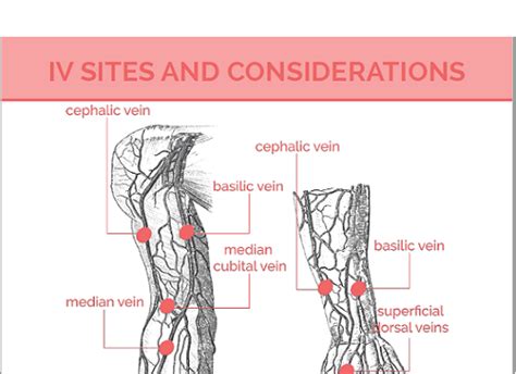 Common Veins Used For Iv Therapy Medical Estudy