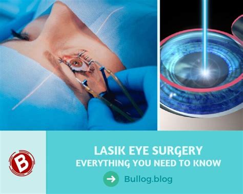 How Lasik Eye Surgery Works Procedure Risks Cost And Recovery