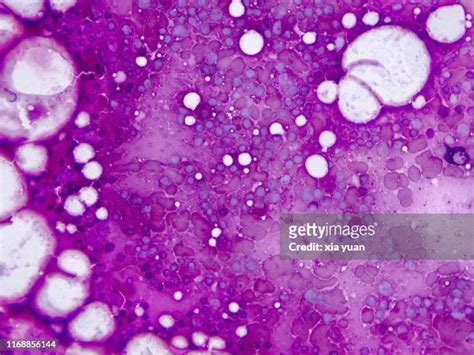 Bone Red Blood Cells Photos And Premium High Res Pictures Getty Images