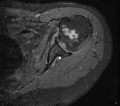 Iqmay21 9fig5 Jbjs Image Quiz