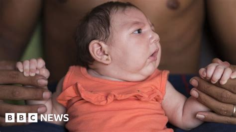 Zika Epidemic Will End In Three Years Study Suggests BBC News