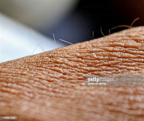 Goose Bumps Arm Photos And Premium High Res Pictures Getty Images