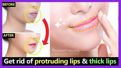 How To Get Rid Of Protruding Mouth And Lips Naturally Make Thick Lips To Thin Lips With Exercises