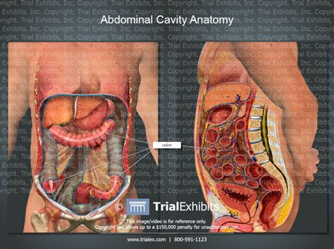 Windham was previously a surgical. Colon - Abdominal Cavity Anatomy - TrialExhibits Inc.