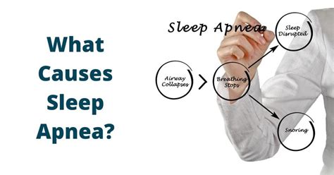 What Causes Sleep Apnea Sound Sleep Medical