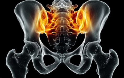 Sacroiliac Joint Mri