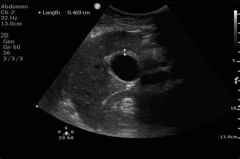 Point Of Care Ultrasound Archiving Requirements Emottawa Blog
