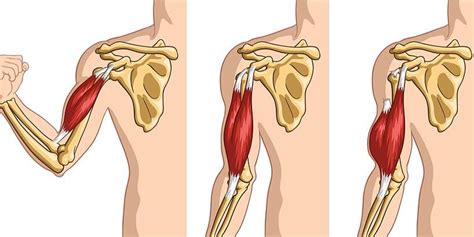 Torn Biceps Prevention And Treatment