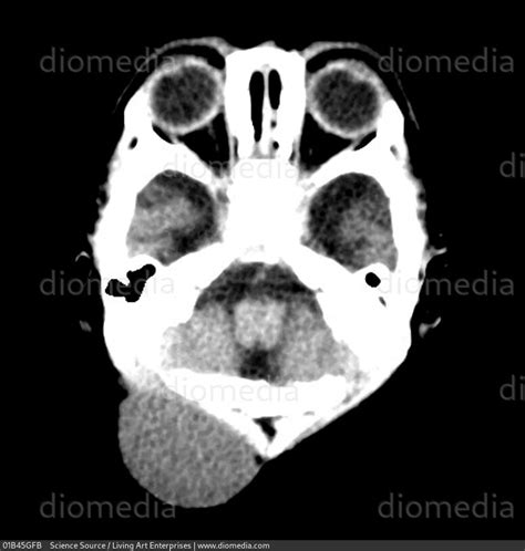 STOCK IMAGE, , BZ3046, 01B45GFB , Science Source - Search Stock Photos