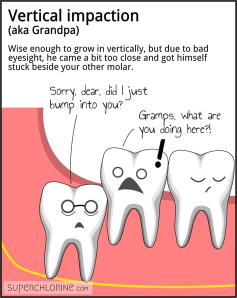 Be sure to talk with your dentist if you suspect your wisdom teeth are growing. Vertical impaction (aka Grandpa). Wise enough to grow in ...