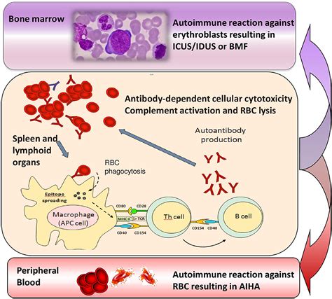 Pathophysiology Of Autoimmune Disease