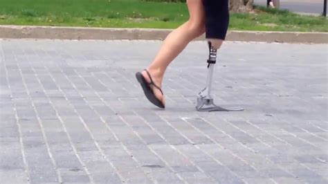 Prosthetic Leg Youtube