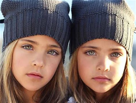 these twins were named “most beautiful in the world ” wait till you see them today zozoup
