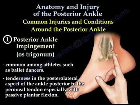 After getting up, i limped for a little bit, before being able to finish my run. Posterior Ankle , Anatomy And Injury - Everything You Need ...