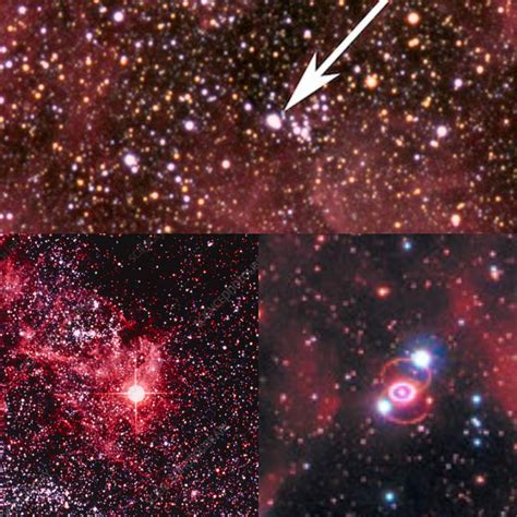 Supernova 1987a Before The Year 1987 In 1987 And 35 Years Later