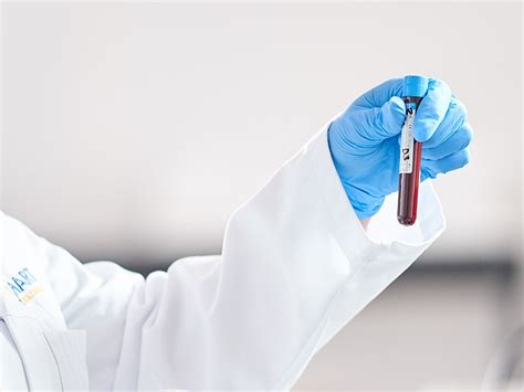 Nhs Blood Test Tube Shortage Hart Biologicals