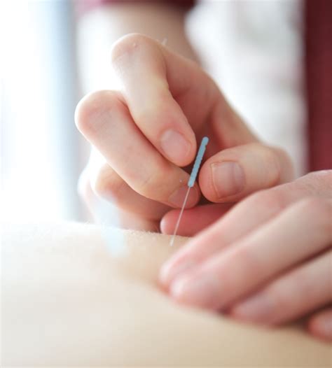 dry needling ims cochrane chiropractor bow river chiropractic and cochrane massage therapy