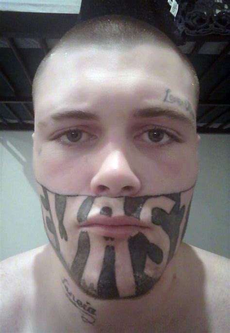 Teen With Devast8 Prison Tattoo Across Face Undergoes Free Laser