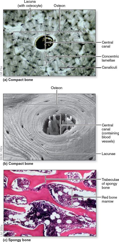 Microscopic Anatomy Of Bone Red Bone Marrow Macro And Micro Red Bone